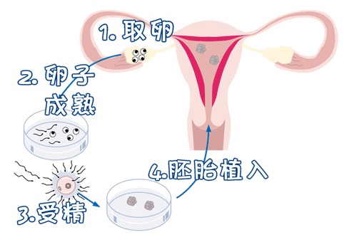 包生男孩的公司